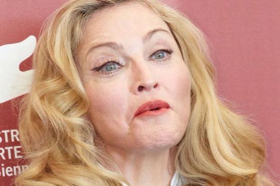 Izobličila se od botoksa: Madonna preterala sa "ulepšavanjem"!
