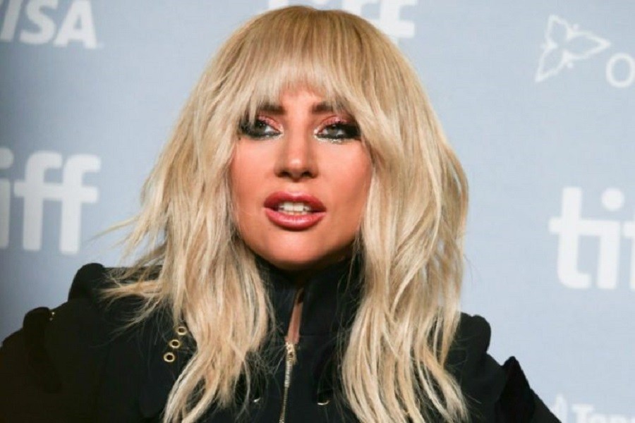 Lejdi Gaga otkazala koncerte zbog zdravstvenih problema