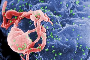 Naučne studije dokazale da HIV pozitivni ljudi sa malom količinom virusa u organizmu ne mogu preneti bolest!