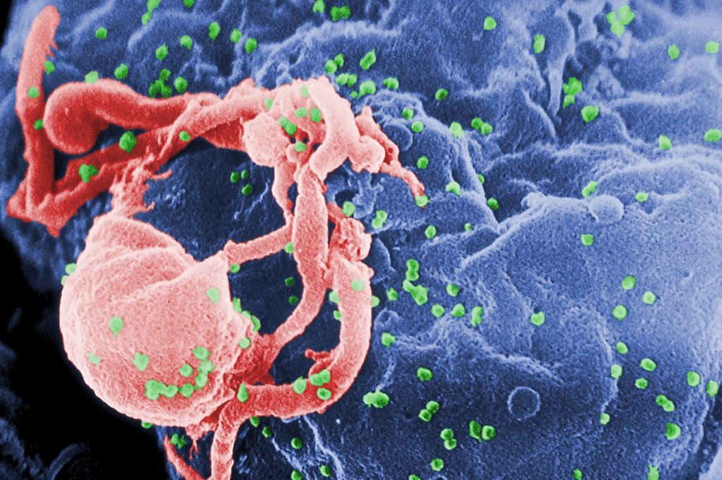 Naučne studije dokazale da HIV pozitivni ljudi sa malom količinom virusa u organizmu ne mogu preneti bolest!