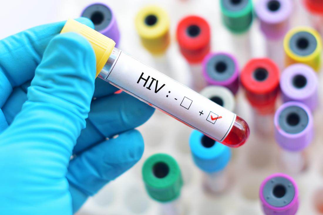 Naučne studije dokazale da HIV pozitivni ljudi ne mogu preneti virus!