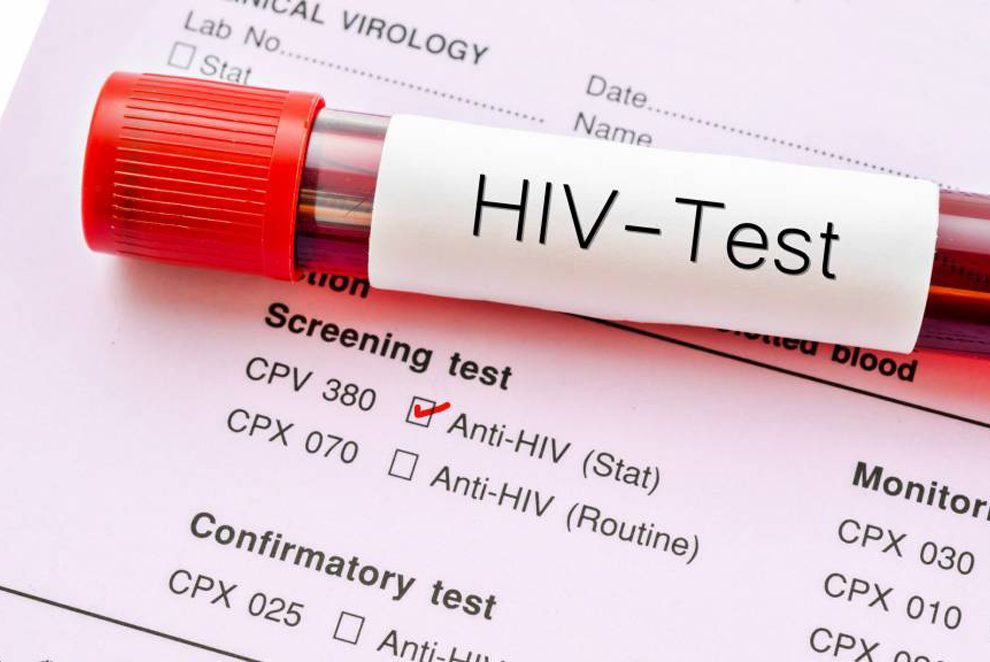 Besplatno testiranje na HIV u subotu u Beogradu